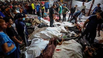 Wounded Palestinians lay at the al-Shifa hospital, following Israeli airstrikes, in Gaza City, central Gaza Strip, Tuesday, Oct. 17, 2023.