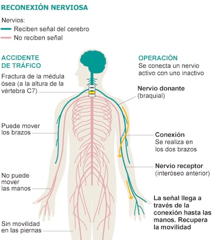 Fuente: Journal of Neurosurgery.