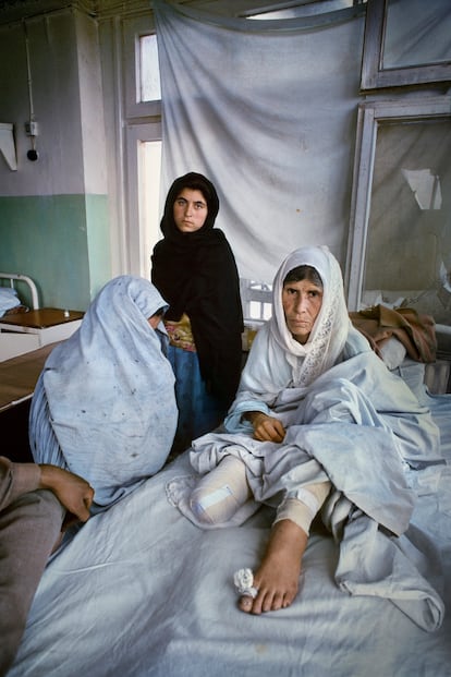 Una mujer víctima de una mina antipersona en Kabul (Afganistán), en 1996.
