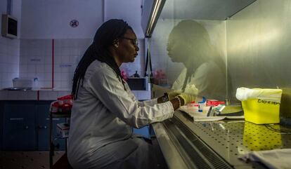 La doctora y biotecnóloga Sandrine Tossu analiza unas muestras de orina de sus pacientes en el departamento de investigación de la tuberculosis del hospital nacional de Cotonou Lazaret.