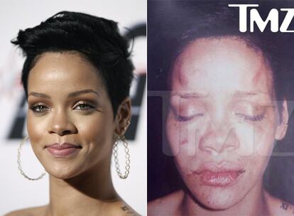 Rihanna, antes y después de la agresión.