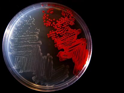 Un cultivo de bacterias en laboratorio.