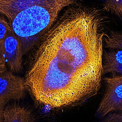 Células de piel humana (queratinocitos HaCaT) que expresan queratina marcada fluorescente.