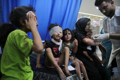 Niños palestinos heridos en los ataques de Israel en el hospital Shifa en la ciudad de Gaza este jueves.