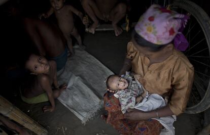 Sntomas de desnutricin en los ni?os de los campamentos de refugiados de Rohingya, en Myanmar.