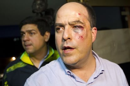 Venezuelan opposition lawmaker Julio Borges was injured in the fight that broke out in the National Assembly Wednesday.