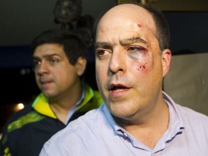 Venezuelan opposition lawmaker Julio Borges was injured in the fight that broke out in the National Assembly Wednesday.