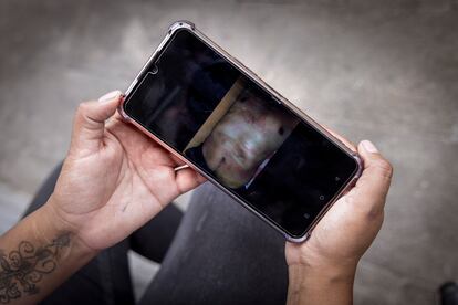 The relative of a prisoner shows photographs of torture suffered by the inmate.