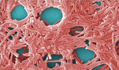 Cultivo de bacterias Legionella pneumophila.