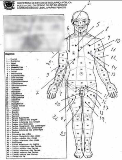 A autópsia que mostra os 30 tiros no corpo do pastor Anderson do Carmo.