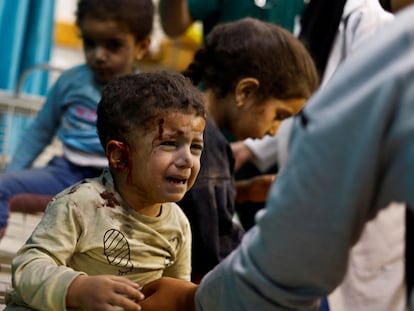 Niños palestinos heridos en un ataque israelí, este domingo en el hospital Nasser, en Gaza.