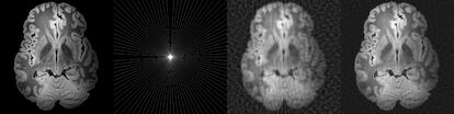 La primera por la izquierda es una imagen de alta resolución de un cerebro (B. L. Edlow et al. Scientific Data 6:244 (2019)). La segunda es una representación de las posibles direcciones del campo magnético de un MRI. La tercera es su reconstrucción usando el análisis de Fourier. La cuarta es la reconstrucción casi perfecta usando la teoría de percepción comprimida.
