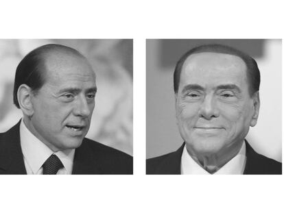 Cómo se diseña un implante de pelo para no acabar como Berlusconi