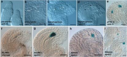 Imagen microscópica de células de una mutante de la planta 'Arabidopsis', en la que se observa la falta de expresión de la proteína argonauta 9, con desarrollo de células reproductoras femeninas anormales (marcadas y señaladas con flechas).