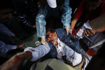 Varios manifestantes trasladan a un hombre herido durante las protestas en Saná.