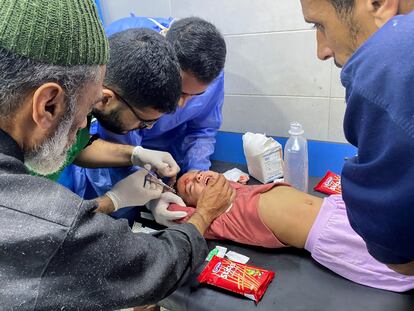 Tres sanitarios del hospital de Al Shifa suturan sin anestesia la cabeza de una niña palestina herida por los bombardeos israelíes.