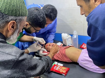 Palestinian girl Orheen Al-Dayah, who was injured on her forehead in an Israeli strike, has her wounds stitched without anaesthesia, at Al Shifa hospital in Gaza City.