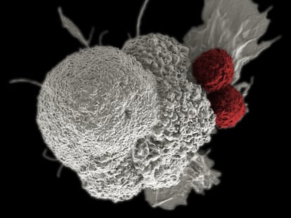 Linfocitos T citotóxicos, en rojo, atacan a células cancerosas, en blanco.