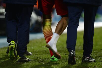 El tobillo derecho de Neymar tras su lesión. 