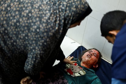 Una niña herida es atendida por un sanitario del hospital Nasser este jueves tras un ataque israelí sobre Jan Yunis. 