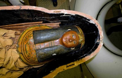 Momia de la princesa del antiguo Egipto Ahmose-Meryet-Amon en la que se ha identificado, mediante tomografía computerizada, que padecía aterosclerosis.