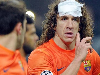 FC Barcelona&#039;s Carles Puyol took a bash to the head in the San Siro.