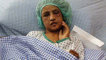 La joven Sahar Gul, en un hospital de Kabul antes de ser trasladada a la India.