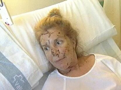 Julia, superviviente del atentado de Yemen, asegura que volverá