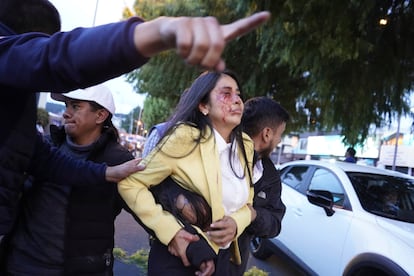 An injured woman is taken to the hospital after the shooting in Quito.