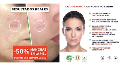Este sérum de vitamina C es el mejor tratamiento antiarrugas.