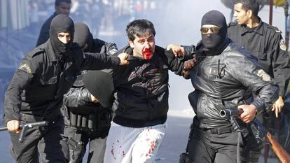 Un hombre herido durante una protesta en Bizerta, a unos 65 kilómetros al noroeste de la ciudad de Túnez.