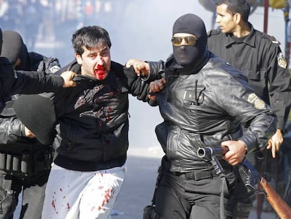 Un hombre herido durante una protesta en Bizerta, a unos 65 kilómetros al noroeste de la ciudad de Túnez.