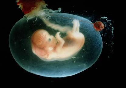 Un embrión humano de ocho semanas.