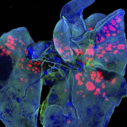 Pulmões de um camundongo, cheios de micropartículas, que aparecem na imagem com as cores vermelho e rosa. Uma tintura fluorescente permitiu aos cientistas visualizar as micropartículas, inclusive uma semana depois de administrar o medicamento que as continha. Esse tipo de imagem serve para pesquisar novas formas de administração de fármacos apenas em partes específicas do organismo, evitando assim os efeitos secundários tóxicos de alguns tratamentos contra o câncer.