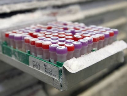 Muestras de ADN congelado y almacenado en la firma Partners HealthCare. 