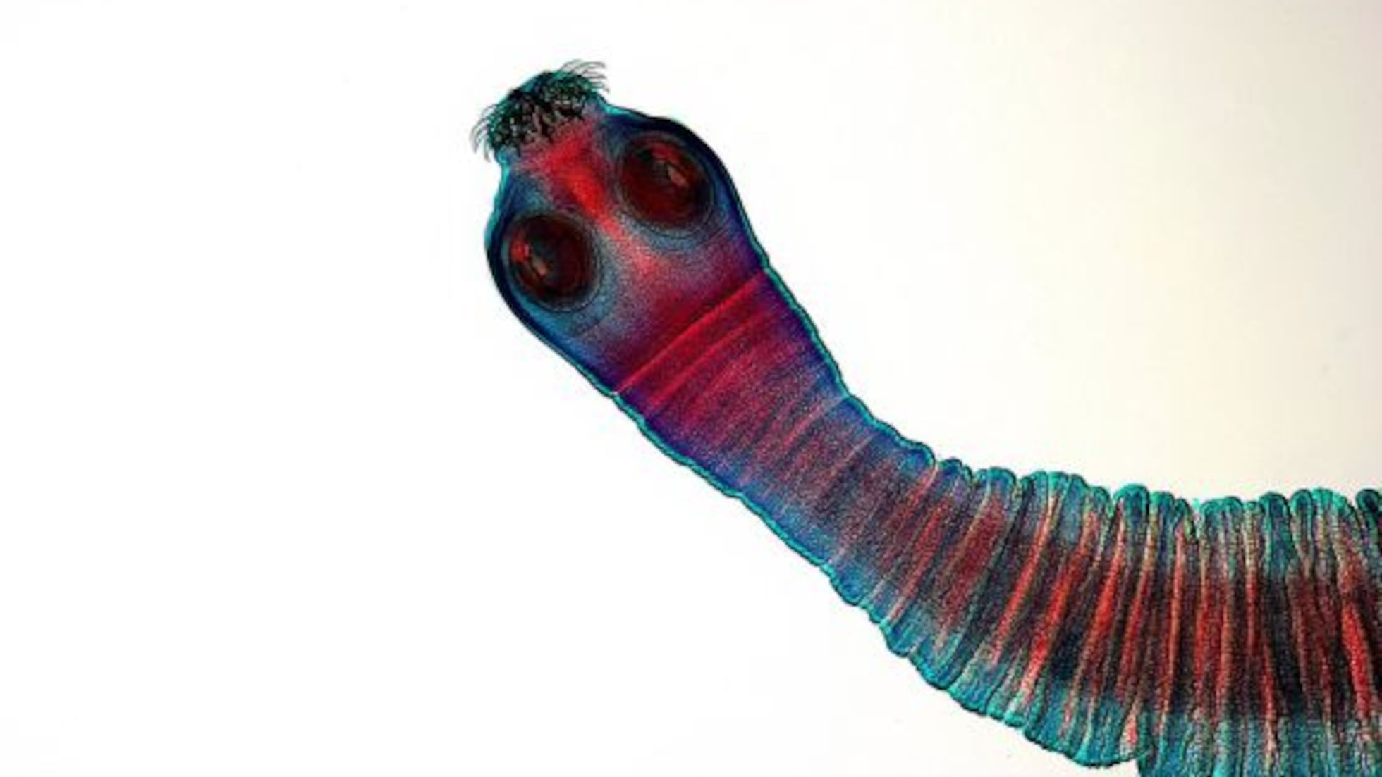 Tenia Insect Dentro De Una Tenia Humana