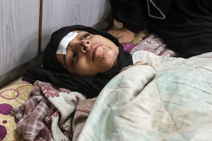 Saja Hamad, en el hospital Al Aqsa, después de su rescate.
 


