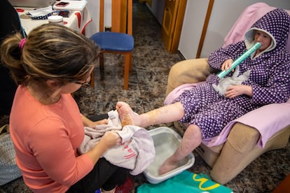 Ariadna's mother, Mari Carmen, helps her daughter with the constant hygiene and hydration that the young woman's skin needs.