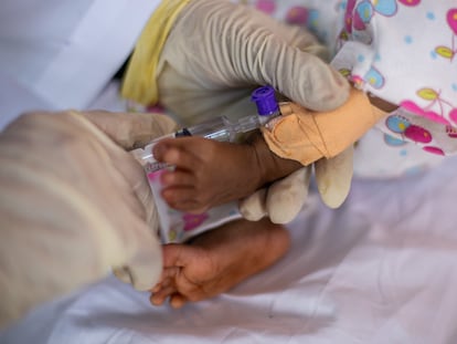 Un bebé de siete meses aquejado de malnutrición es atendido en Yemen, en 2021.