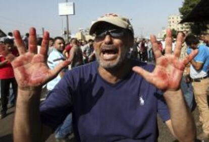 Un manifestante muestra sus manos ensangrentadas durante choques entre simpatizantes de los Hermanos Musulmanes del depuesto presidente egipcio Mohamed Mursi y la polic&iacute;a, cerca de la plaza de Rams&eacute;s, en El Cairo (Egipto), hoy, viernes 16 de agosto de 2013. M&aacute;s de 30 personas murieron hoy en los choques entre partidarios y detractores de Mursi en el barrio de Rams&eacute;s, en el centro de El Cairo, seg&uacute;n los Hermanos Musulmanes. EFE/Khaled Elfiqi