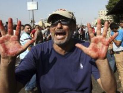 Un manifestante muestra sus manos ensangrentadas durante choques entre simpatizantes de los Hermanos Musulmanes del depuesto presidente egipcio Mohamed Mursi y la polic&iacute;a, cerca de la plaza de Rams&eacute;s, en El Cairo (Egipto), hoy, viernes 16 de agosto de 2013. M&aacute;s de 30 personas murieron hoy en los choques entre partidarios y detractores de Mursi en el barrio de Rams&eacute;s, en el centro de El Cairo, seg&uacute;n los Hermanos Musulmanes. EFE/Khaled Elfiqi