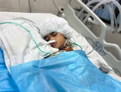 Ghazel, de 10 años, en su cama de UCI, tras dos semanas ingresada a causa de las heridas producidas por una bomba israelí. La metralla le produjo lesión medular cervical irreversible con tetraplejia y necesidad permanente de ventilación mecánica, razón por la cual ha tenido que ser traqueostomizada. (Jan Yunis, 7 de junio de 2025).