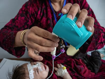 En Afganistán, Zakia, de un mes y medio, sufre de desnutrición aguda severa con complicaciones. Es alimentada por su madre con leche terapéutica a través de una sonda naso gástrica porque está demasiado enferma para amamantar.