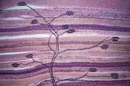 Sinapsis de una motoneurona con células musculares esqueléticas.