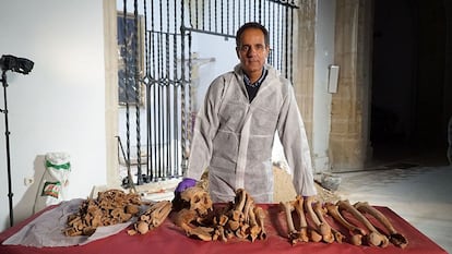 Forensic scientist José Antonio Lorente shows remains exhumed during the investigation.