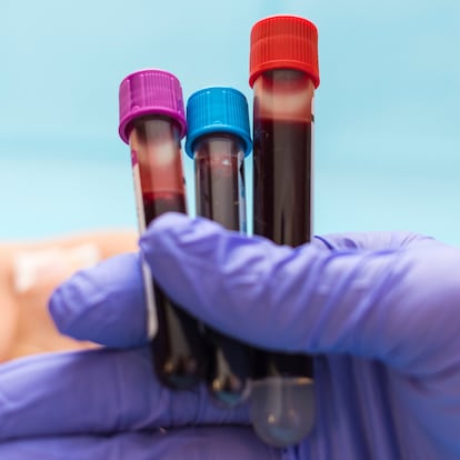 Blood test vials for blood groups held by nurse. Blood analysis concept, selective focus, copy space