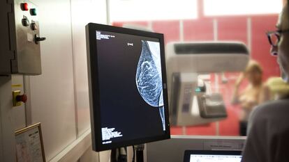Imagen de mamograf&iacute;a.
