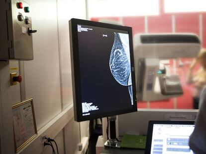 Mammography screening.