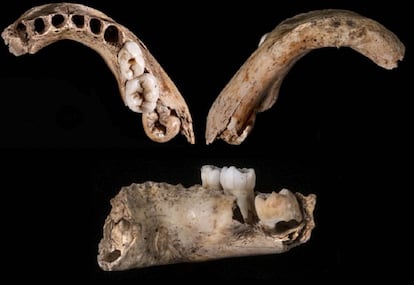 Three views of the five-year-old boy’s jaw from the El Castillo cave in Cantabria.