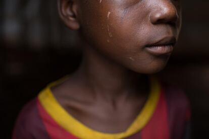 Hubert (nombre ficticio), en un campo de atención a niños de UNICEF en Bambari (República Centroafricana). Hubert es uno de los más de 300 niños -algunos menores de 12 años- que fueron liberados en mayo de 2015 por distintos grupos armados del país.